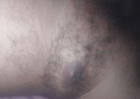 Oserez vous