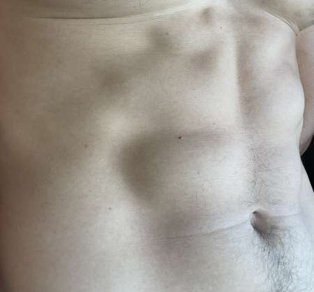 Oserez vous